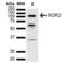 Receptor Tyrosine Kinase Like Orphan Receptor 2 antibody, LS-C774397, Lifespan Biosciences, Western Blot image 