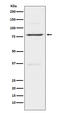 Insulin Receptor Related Receptor antibody, M08212, Boster Biological Technology, Western Blot image 