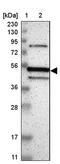 CUGBP Elav-Like Family Member 3 antibody, PA5-52272, Invitrogen Antibodies, Western Blot image 