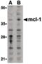 MCL1 Apoptosis Regulator, BCL2 Family Member antibody, PA5-20121, Invitrogen Antibodies, Western Blot image 