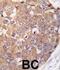 SNK antibody, abx033265, Abbexa, Immunohistochemistry paraffin image 