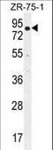 Beta-Transducin Repeat Containing E3 Ubiquitin Protein Ligase antibody, LS-C156893, Lifespan Biosciences, Western Blot image 