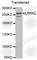 Leucine Rich Repeat Kinase 2 antibody, A0859, ABclonal Technology, Western Blot image 