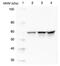 SRC Proto-Oncogene, Non-Receptor Tyrosine Kinase antibody, M00107-2, Boster Biological Technology, Western Blot image 