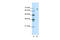 Gamma-Aminobutyric Acid Type A Receptor Theta Subunit antibody, 28-265, ProSci, Western Blot image 