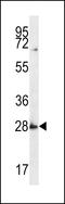 Synaptophysin Like 1 antibody, LS-C161648, Lifespan Biosciences, Western Blot image 