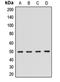 Rho GTPase-activating protein 1 antibody, orb412198, Biorbyt, Western Blot image 