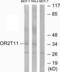 Olfactory Receptor Family 2 Subfamily T Member 11 (Gene/Pseudogene) antibody, PA5-38170, Invitrogen Antibodies, Western Blot image 