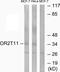 Olfactory Receptor Family 2 Subfamily T Member 11 (Gene/Pseudogene) antibody, PA5-38170, Invitrogen Antibodies, Western Blot image 