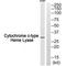 Holocytochrome C Synthase antibody, A00924, Boster Biological Technology, Western Blot image 