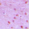 Replication Factor C Subunit 3 antibody, LS-C352770, Lifespan Biosciences, Immunohistochemistry paraffin image 