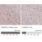 Charged Multivesicular Body Protein 4B antibody, NBP2-49018, Novus Biologicals, Immunohistochemistry paraffin image 