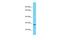 Chromosome 19 Open Reading Frame 57 antibody, A15004, Boster Biological Technology, Western Blot image 