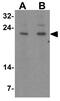 BCL2 Related Protein A1 antibody, GTX31739, GeneTex, Western Blot image 
