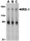 Insulin Receptor Substrate 1 antibody, MBS150253, MyBioSource, Western Blot image 