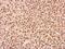 SET Domain Containing 2, Histone Lysine Methyltransferase antibody, GTX127905, GeneTex, Immunohistochemistry paraffin image 