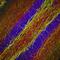 Neurofilament Heavy antibody, PA1-10016, Invitrogen Antibodies, Immunofluorescence image 