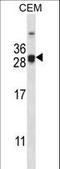 Cell Death Inducing DFFA Like Effector A antibody, LS-B10551, Lifespan Biosciences, Western Blot image 