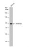 Signal Transducer And Activator Of Transcription 5A antibody, NBP2-20505, Novus Biologicals, Western Blot image 