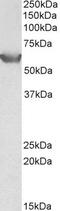 Solute Carrier Family 22 Member 3 antibody, PA5-37889, Invitrogen Antibodies, Western Blot image 