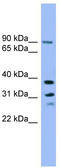 Phospholysine Phosphohistidine Inorganic Pyrophosphate Phosphatase antibody, TA344695, Origene, Western Blot image 