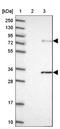 Zinc Finger Containing Ubiquitin Peptidase 1 antibody, NBP1-92646, Novus Biologicals, Western Blot image 