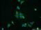 Endoplasmic Reticulum-Golgi Intermediate Compartment 1 antibody, 16108-1-AP, Proteintech Group, Immunofluorescence image 