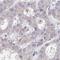 PRAME Family Member 7 antibody, HPA049887, Atlas Antibodies, Immunohistochemistry frozen image 