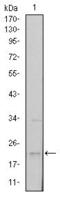 Snail Family Transcriptional Repressor 1 antibody, GTX60382, GeneTex, Western Blot image 