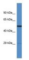 Adhesion Molecule With Ig Like Domain 2 antibody, NBP1-79603, Novus Biologicals, Western Blot image 