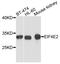 Eukaryotic translation initiation factor 4E type 2 antibody, A05869, Boster Biological Technology, Western Blot image 