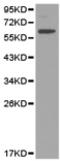 Killer Cell Immunoglobulin Like Receptor, Two Ig Domains And Long Cytoplasmic Tail 3 antibody, TA321841, Origene, Western Blot image 