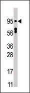 Signal Transducer And Activator Of Transcription 5A antibody, MBS9211000, MyBioSource, Western Blot image 