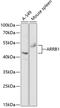 Arrestin Beta 1 antibody, 13-074, ProSci, Western Blot image 