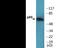 p65 antibody, EKC2011, Boster Biological Technology, Western Blot image 