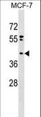 Phospholipid Phosphatase 6 antibody, LS-C158701, Lifespan Biosciences, Western Blot image 