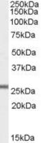 Glutathione peroxidase 3 antibody, GTX89142, GeneTex, Western Blot image 