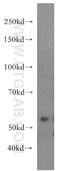 Mitogen-Activated Protein Kinase Kinase Kinase 20 antibody, 14945-1-AP, Proteintech Group, Western Blot image 