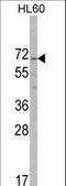 AlkB Homolog 8, TRNA Methyltransferase antibody, LS-C156285, Lifespan Biosciences, Western Blot image 