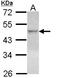 Nuclear Receptor Subfamily 1 Group H Member 2 antibody, LS-C109525, Lifespan Biosciences, Western Blot image 