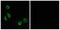 G Protein-Coupled Receptor Class C Group 5 Member D antibody, A30828, Boster Biological Technology, Immunohistochemistry paraffin image 