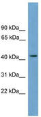 Major Facilitator Superfamily Domain Containing 3 antibody, TA339910, Origene, Western Blot image 