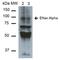 Amiloride-sensitive sodium channel subunit alpha antibody, LS-C774304, Lifespan Biosciences, Western Blot image 