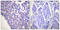 Caldesmon 1 antibody, LS-C198714, Lifespan Biosciences, Immunohistochemistry paraffin image 