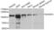 EWS RNA Binding Protein 1 antibody, LS-C346054, Lifespan Biosciences, Western Blot image 