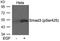 SMAD Family Member 3 antibody, PA5-37636, Invitrogen Antibodies, Western Blot image 