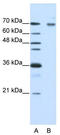 Frizzled Class Receptor 7 antibody, TA344065, Origene, Western Blot image 