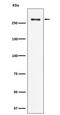 Chromodomain Helicase DNA Binding Protein 3 antibody, M03200-1, Boster Biological Technology, Western Blot image 