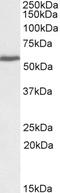 NEDD4-binding protein 2-like 2 isoform 1 antibody, STJ70139, St John