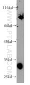 Septin-4 antibody, 12476-1-AP, Proteintech Group, Western Blot image 